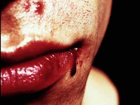 Избитый человек, фото с сайта mignews.com.ua Избитый человек, фото с сайта mignews.com.ua