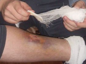 После встречи с полицией. Фото с сайта Казанского правозащитного центра После встречи с полицией. Фото с сайта Казанского правозащитного центра