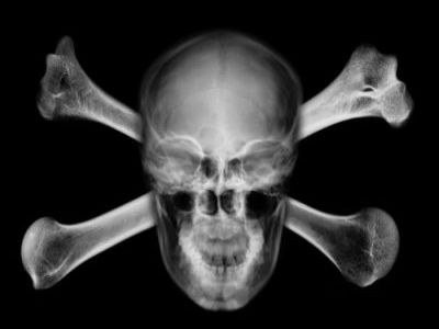 Рентген. Фото: foto.tut.by Рентген. Фото: foto.tut.by