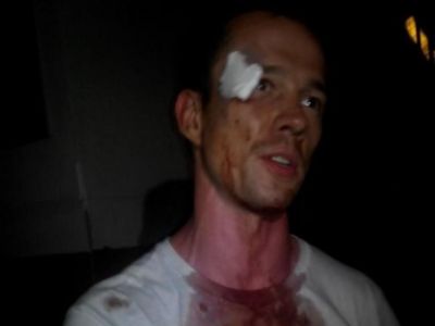 Активист Ильдар Дадин. Фото: twitter.com Активист Ильдар Дадин. Фото: twitter.com