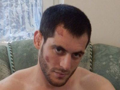 Мурад Амриев после пыьток. Фото: КПП Мурад Амриев после пыьток. Фото: КПП