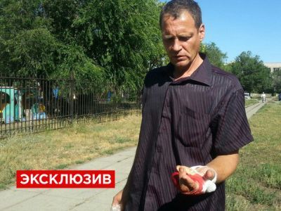 Магнитогорец, отрезавший палец. Фото: Life.Ru Магнитогорец, отрезавший палец. Фото: Life.Ru