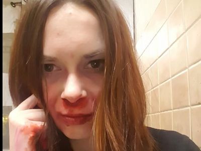 Избитая член ОНК Дарья Беляева. Фото: https://www.facebook.com/ Избитая член ОНК Дарья Беляева. Фото: https://www.facebook.com/