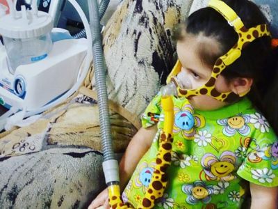 СМА у детей. Фото: Мел СМА у детей. Фото: Мел